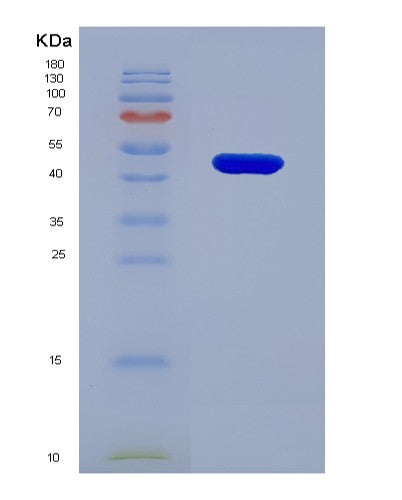 SDS-PAGE analysis of Human KPNB1 (Importin Subunit Beta-1) - Recombinant Protein, showing >95% purity under 15% SDS-PAGE (Reduced)