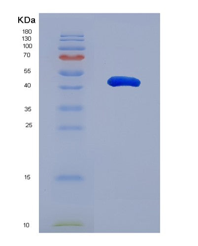 SDS-PAGE analysis of Human TINAGL1 (Tubulointerstitial Nephritis Antigen-Like) - Recombinant Protein, showing >95% purity under 15% SDS-PAGE (Reduced)