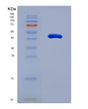 SDS-PAGE analysis of Human TINAGL1 (Tubulointerstitial Nephritis Antigen-Like) - Recombinant Protein, showing >95% purity under 15% SDS-PAGE (Reduced)
