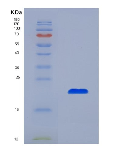 SDS-PAGE analysis of Human MAP1LC3B (Microtubule-Associated Protein 1 Light Chain 3 Beta) - Recombinant Protein, showing >85% purity under 15% SDS-PAGE (Reduced)