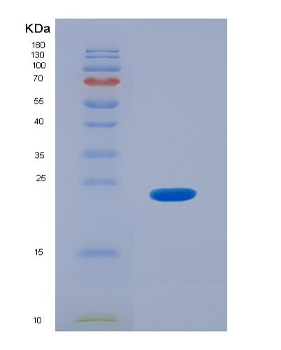 SDS-PAGE analysis of Human LAT2 (Linker For Activation Of T-Cells Family Member 2) - Recombinant Protein, showing >95% purity under 15% SDS-PAGE (Reduced)