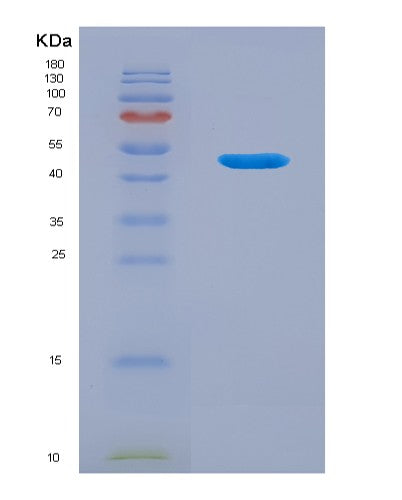 SDS-PAGE analysis of Human LACRT (Extracellular Glycoprotein Lacritin) - Recombinant Protein, showing >95% purity under 15% SDS-PAGE (Reduced)