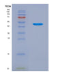 SDS-PAGE analysis of Human LACRT (Extracellular Glycoprotein Lacritin) - Recombinant Protein, showing >95% purity under 15% SDS-PAGE (Reduced)