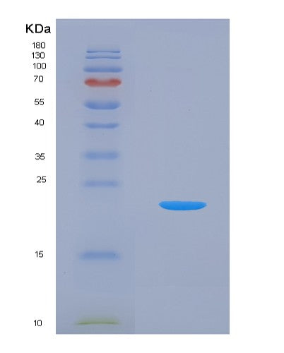 SDS-PAGE analysis of Human UBA5 (Ubiquitin-Like Modifier-Activating Enzyme 5) - Recombinant Protein, showing >95% purity under 15% SDS-PAGE (Reduced)