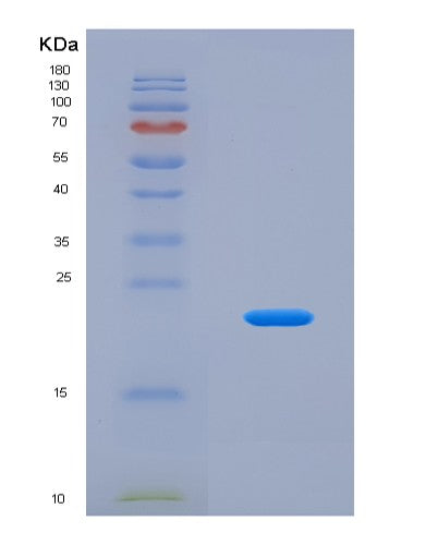SDS-PAGE analysis of Human ZBP1 (Z-Dna-Binding Protein 1) - Recombinant Protein, showing >90% purity under 15% SDS-PAGE (Reduced)
