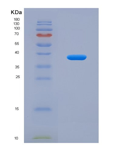 SDS-PAGE analysis of Human SDCBP2 (Syntenin-2) - Recombinant Protein, showing >95% purity under 15% SDS-PAGE (Reduced)