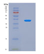 SDS-PAGE analysis of Human SDCBP2 (Syntenin-2) - Recombinant Protein, showing >95% purity under 15% SDS-PAGE (Reduced)