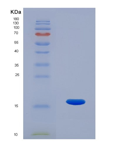 SDS-PAGE analysis of Human RNASE7 (Ribonuclease 7) - Recombinant Protein, showing >95% purity under 15% SDS-PAGE (Reduced)