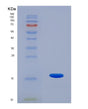 SDS-PAGE analysis of Human RNASE7 (Ribonuclease 7) - Recombinant Protein, showing >95% purity under 15% SDS-PAGE (Reduced)