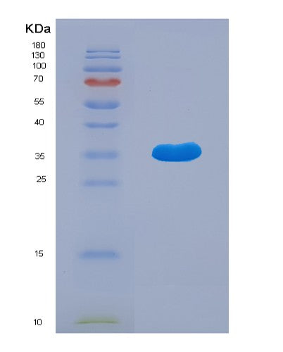 SDS-PAGE analysis of Human ATG5 (Autophagy Protein 5) - Recombinant Protein, showing >95% purity under 15% SDS-PAGE (Reduced)
