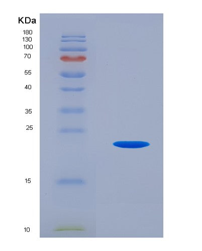 SDS-PAGE analysis of Human IL25 (Interleukin-25) - Recombinant Protein, showing >85% purity under 15% SDS-PAGE (Reduced)