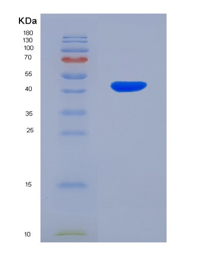 SDS-PAGE analysis of Human BHMT2 (S-Methylmethionine--Homocysteine S-Methyltransferase Bhmt2) - Recombinant Protein, showing >85% purity under 15% SDS-PAGE (Reduced)