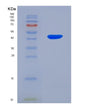 SDS-PAGE analysis of Human BHMT2 (S-Methylmethionine--Homocysteine S-Methyltransferase Bhmt2) - Recombinant Protein, showing >85% purity under 15% SDS-PAGE (Reduced)