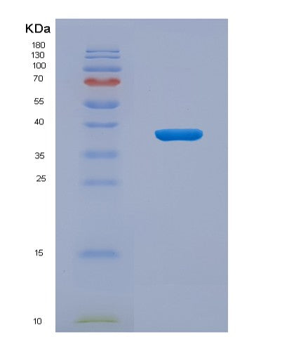 SDS-PAGE analysis of Human CENPH (Centromere Protein H) - Recombinant Protein, showing >95% purity under 15% SDS-PAGE (Reduced)