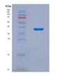 SDS-PAGE analysis of Human CENPH (Centromere Protein H) - Recombinant Protein, showing >95% purity under 15% SDS-PAGE (Reduced)