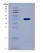 SDS-PAGE analysis of Human FN3K (Fructosamine-3-Kinase) - Recombinant Protein, showing >85% purity under 15% SDS-PAGE (Reduced)