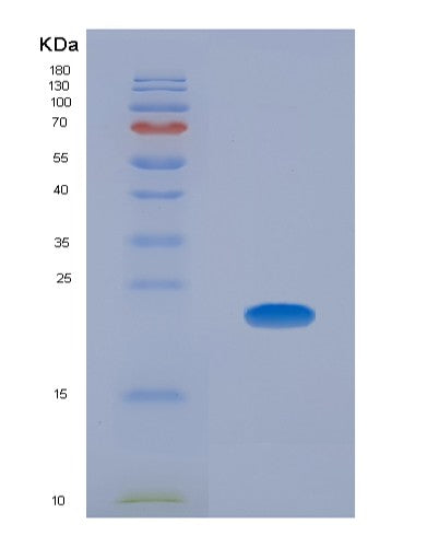 SDS-PAGE analysis of Human CLMP (Cxadr-Like Membrane Protein) - Recombinant Protein, showing >95% purity under 15% SDS-PAGE (Reduced)