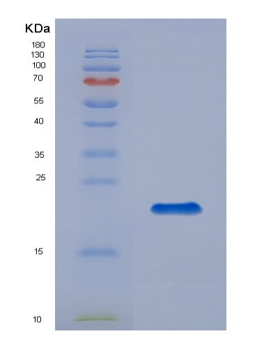 SDS-PAGE analysis of Human GREM2 (Gremlin-2) - Recombinant Protein, showing >95% purity under 15% SDS-PAGE (Reduced)