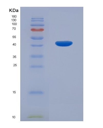 SDS-PAGE analysis of Human NHEJ1 (Non-Homologous End-Joining Factor 1) - Recombinant Protein, showing >85% purity under 15% SDS-PAGE (Reduced)
