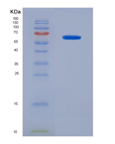 SDS-PAGE analysis of Human NANOG (Homeobox Protein Nanog) - Recombinant Protein, showing >95% purity under 15% SDS-PAGE (Reduced)