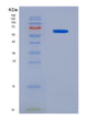 SDS-PAGE analysis of Human NANOG (Homeobox Protein Nanog) - Recombinant Protein, showing >95% purity under 15% SDS-PAGE (Reduced)