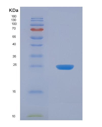 SDS-PAGE analysis of Human UCK1 (Uridine-Cytidine Kinase 1) - Recombinant Protein, showing >95% purity under 15% SDS-PAGE (Reduced)
