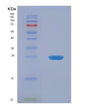 SDS-PAGE analysis of Human UCK1 (Uridine-Cytidine Kinase 1) - Recombinant Protein, showing >95% purity under 15% SDS-PAGE (Reduced)