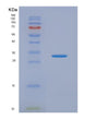 SDS-PAGE analysis of Human CACYBP (Calcyclin-Binding Protein) - Recombinant Protein, showing >95% purity under 15% SDS-PAGE (Reduced)