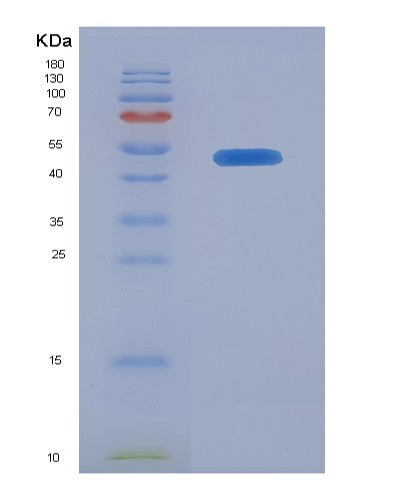 SDS-PAGE analysis of Human CRLF2 (Cytokine Receptor-Like Factor 2) - Recombinant Protein, showing >85% purity under 15% SDS-PAGE (Reduced)