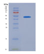 SDS-PAGE analysis of Human CRLF2 (Cytokine Receptor-Like Factor 2) - Recombinant Protein, showing >85% purity under 15% SDS-PAGE (Reduced)