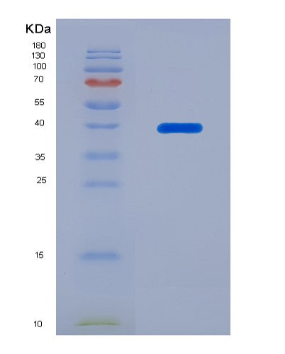 SDS-PAGE analysis of Human S100A14 (Protein S100-A14) - Recombinant Protein, showing >85% purity under 15% SDS-PAGE (Reduced)