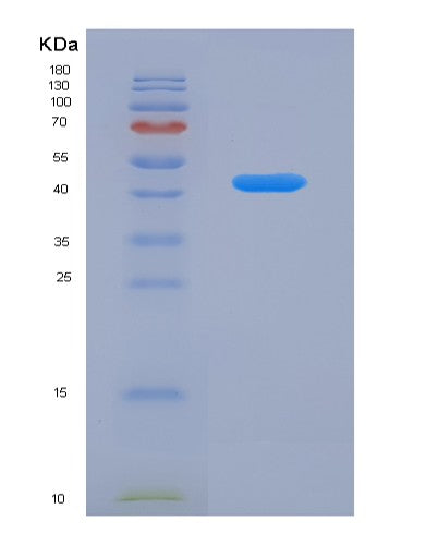 SDS-PAGE analysis of Human SRA1 (Steroid Receptor Rna Activator 1) - Recombinant Protein, showing >90% purity under 15% SDS-PAGE (Reduced)