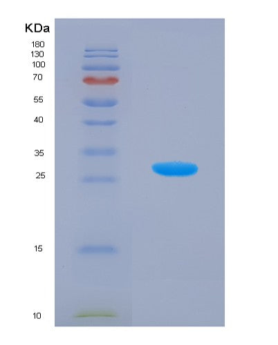 SDS-PAGE analysis of Human APMAP (Adipocyte Plasma Membrane-Associated Protein) - Recombinant Protein, showing >90% purity under 15% SDS-PAGE (Reduced)