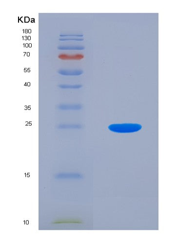SDS-PAGE analysis of Human Diablo Homolog (DIABLO) - Recombinant Protein, showing >95% purity under 15% SDS-PAGE (Reduced)