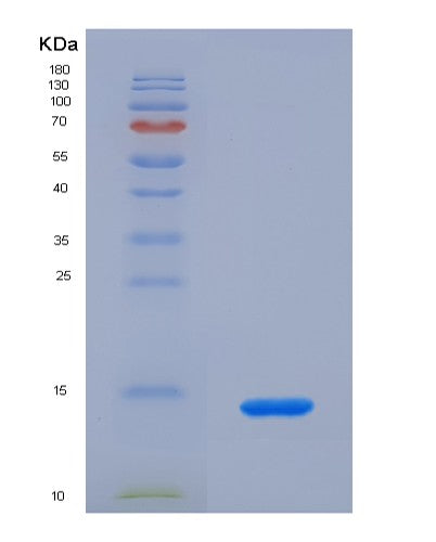 SDS-PAGE analysis of Mouse Ccl24 (C-C Motif Chemokine 24) - Recombinant Protein, showing >85% purity under 15% SDS-PAGE (Reduced)