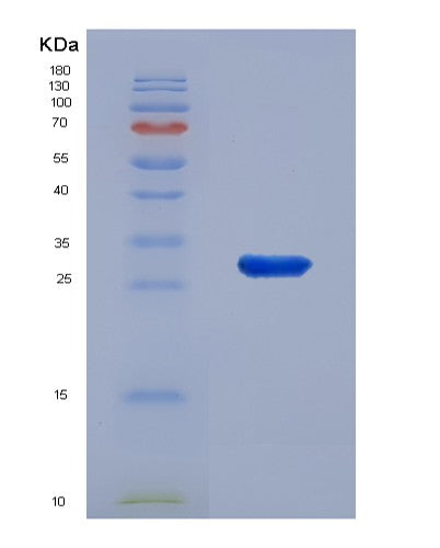 SDS-PAGE analysis of Human EXOSC4 (Exosome Complex Component Rrp41) - Recombinant Protein, showing >85% purity under 15% SDS-PAGE (Reduced)