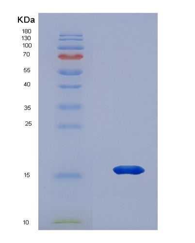 SDS-PAGE analysis of Human NRN1 (Neuritin) - Recombinant Protein, showing >90% purity under 15% SDS-PAGE (Reduced)