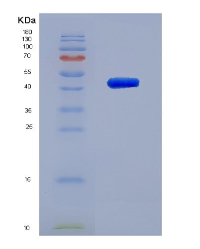 SDS-PAGE analysis of Human ACP6 (Lysophosphatidic Acid Phosphatase Type 6) - Recombinant Protein, showing >95% purity under 15% SDS-PAGE (Reduced)