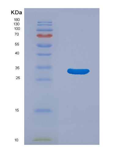 SDS-PAGE analysis of Human NRIP3 (Nuclear Receptor-Interacting Protein 3) - Recombinant Protein, showing >95% purity under 15% SDS-PAGE (Reduced)