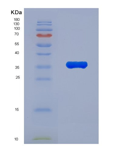 SDS-PAGE analysis of Human TIGAR (Fructose-2,6-Bisphosphatase Tigar) - Recombinant Protein, showing >85% purity under 15% SDS-PAGE (Reduced)