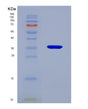 SDS-PAGE analysis of Human RTN4 (Reticulon-4) - Recombinant Protein, showing >85% purity under 15% SDS-PAGE (Reduced)