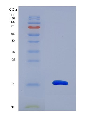 SDS-PAGE analysis of Human CCL28 (C-C Motif Chemokine 28) - Recombinant Protein, showing >95% purity under 15% SDS-PAGE (Reduced)