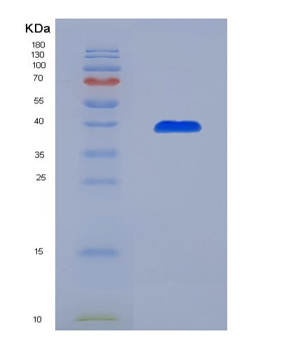 SDS-PAGE analysis of Human AASDHPPT (L-Aminoadipate-Semialdehyde Dehydrogenase-Phosphopantetheinyl Transferase) - Recombinant Protein, showing >85% purity under 15% SDS-PAGE (Reduced)