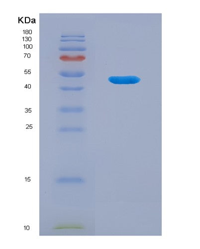 SDS-PAGE analysis of Human GKN1 (Gastrokine-1) - Recombinant Protein, showing >85% purity under 15% SDS-PAGE (Reduced)