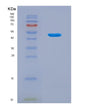 SDS-PAGE analysis of Human GKN1 (Gastrokine-1) - Recombinant Protein, showing >85% purity under 15% SDS-PAGE (Reduced)