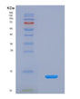 SDS-PAGE analysis of Human CTNNBIP1 (Beta-Catenin-Interacting Protein 1) - Recombinant Protein, showing >85% purity under 15% SDS-PAGE (Reduced)