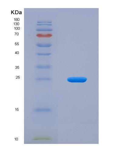 SDS-PAGE analysis of Human TDP1 (Tyrosyl-Dna Phosphodiesterase 1) - Recombinant Protein, showing >95% purity under 15% SDS-PAGE (Reduced)