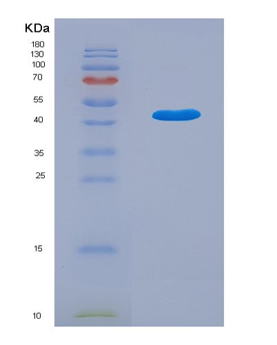 SDS-PAGE analysis of Human TBC1D13 (Tbc1 Domain Family Member 13) - Recombinant Protein, showing >85% purity under 15% SDS-PAGE (Reduced)