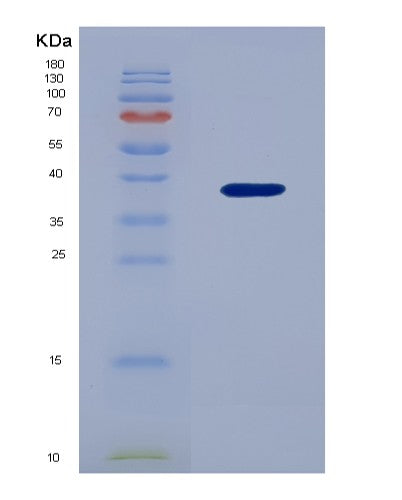 SDS-PAGE analysis of Human UBAP1 (Ubiquitin-Associated Protein 1) - Recombinant Protein, showing >85% purity under 15% SDS-PAGE (Reduced)