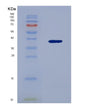 SDS-PAGE analysis of Human UBAP1 (Ubiquitin-Associated Protein 1) - Recombinant Protein, showing >85% purity under 15% SDS-PAGE (Reduced)